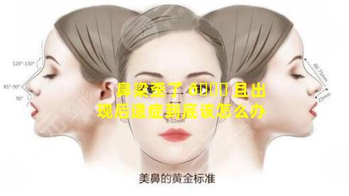 鼻梁歪了 🐘 且出现后遗症到底该怎么办